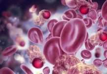 Treatment of prostate cancer with internal radiation soon