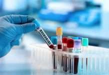 Scientists develop a blood test to diagnose Alzheimer’s