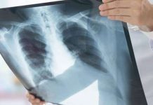 70,000 registered cancer cases in Iraqi Kurdistan